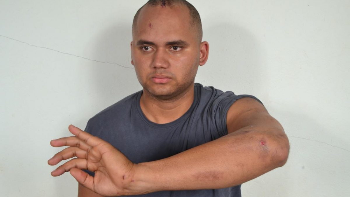 Morte em bar: Defesa de PM fala sobre o caso e apresenta fotos do policial agredido