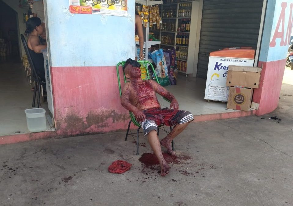 Em tentativa de homicídio, homem é atingido por “terçadadas” no Betânia